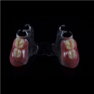 תותבת חלקית אקרילית נשלפת