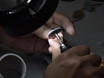 כמה זמן מחזיקים כתרי PFM? תוחלת חיים ממוצעת, גורמים וטיפים לטיפול