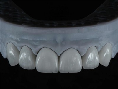 כיצד לבצע מיקור חוץ לעבודה של טכנאי מעבדת שיניים בחו